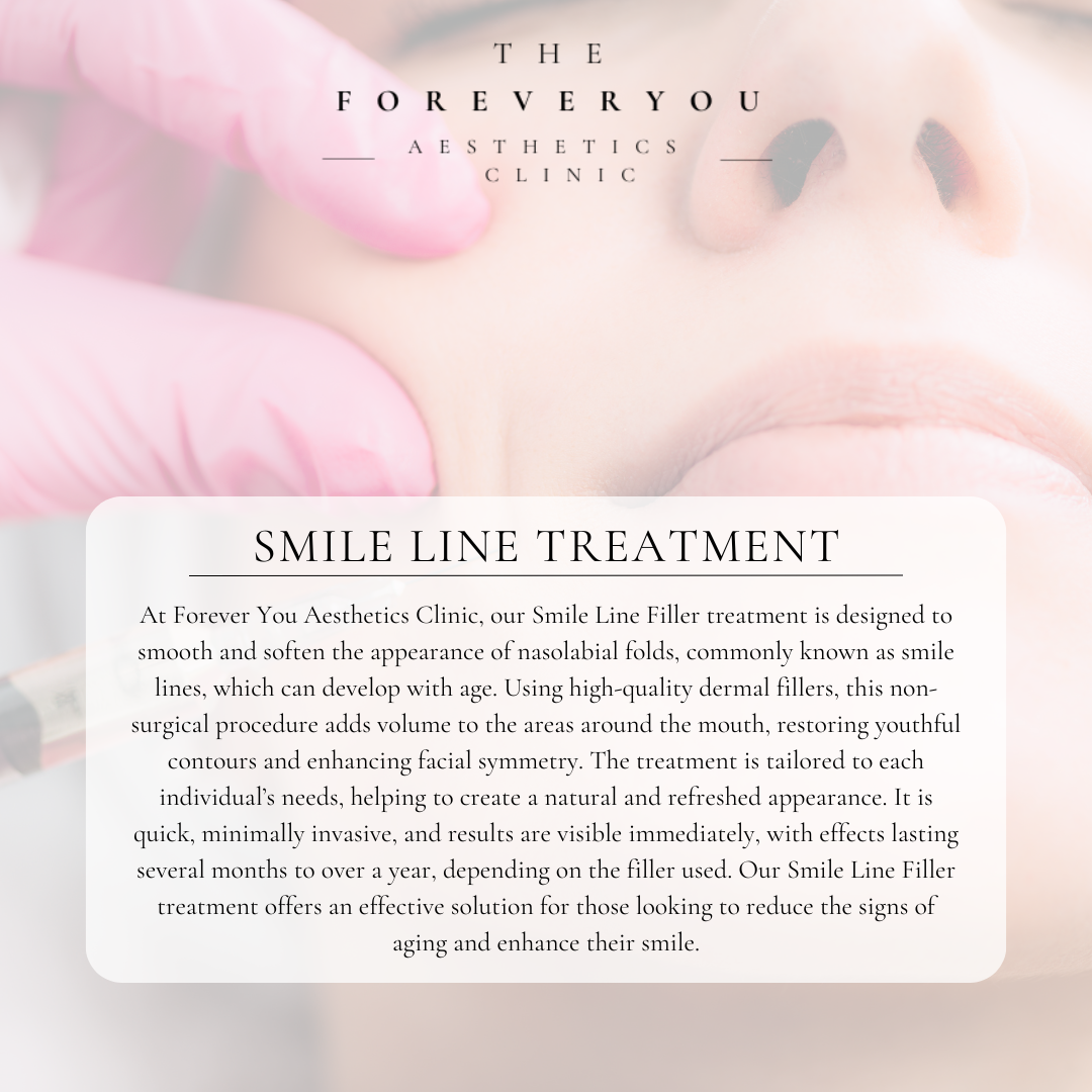 Smile Line Filler 1.1ml